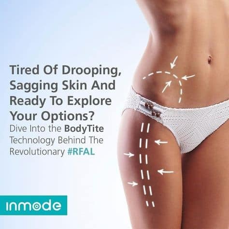 1747780838_BodyTite3 Skin Tightening