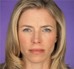 1747780995_Botox_01a Botox