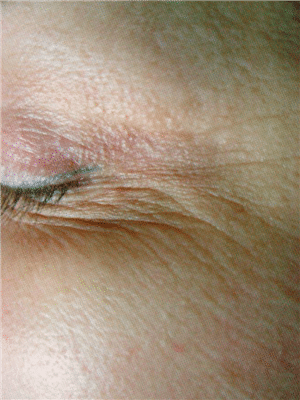 1747781068_Pelleve-01 Pellevé