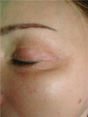 1747781077_Pelleve-01a Pellevé