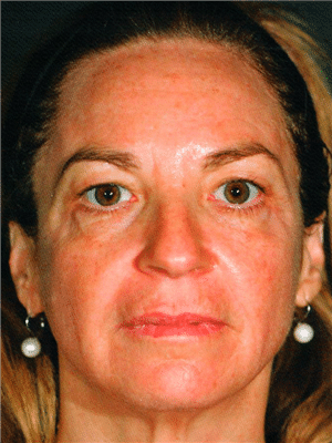 1747781095_Pelleve-02a Pellevé