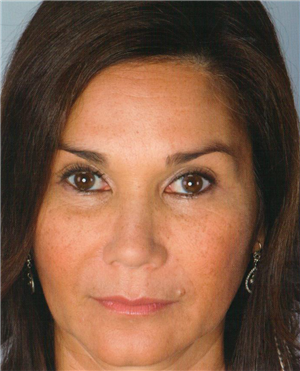 After Image: Artefill - front