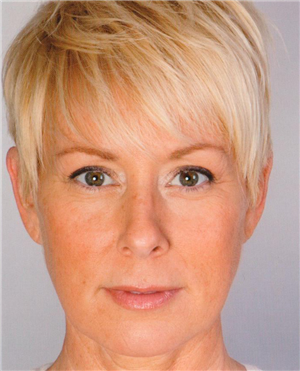 After Image: Artefill - front