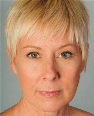 Before Image: Artefill - front