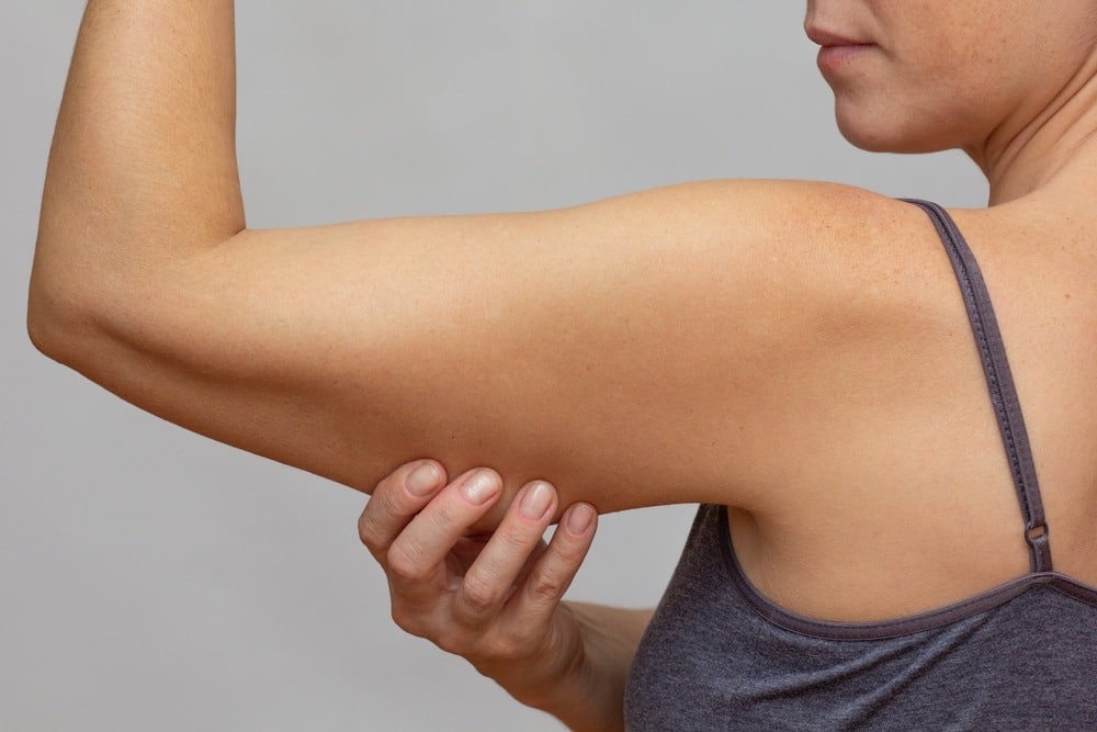 Arm Liposuction in Panama City, FL